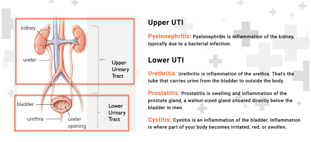 Upper and lower UTIs explained